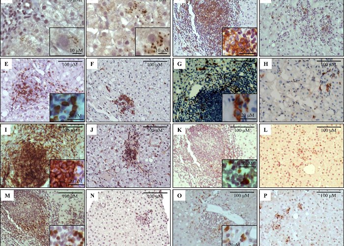 J. M. Ramos Mejía General Hospital Frontiers | Chronic Hepatitis C Pathogenesis: Immune Response in ... photo